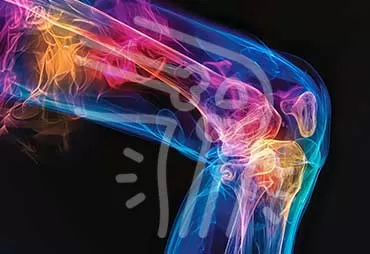 Orthopedic Infections